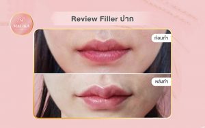 filler cover review ads