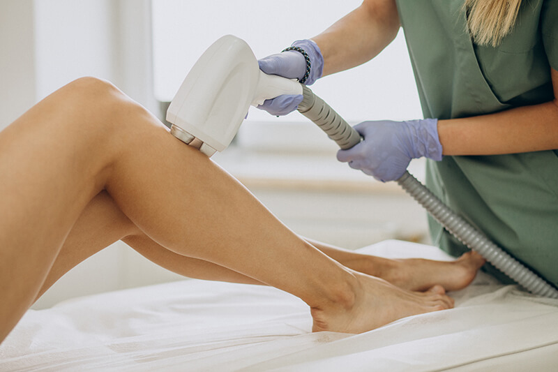 laser-epilation-hair-removal-therapy (1)