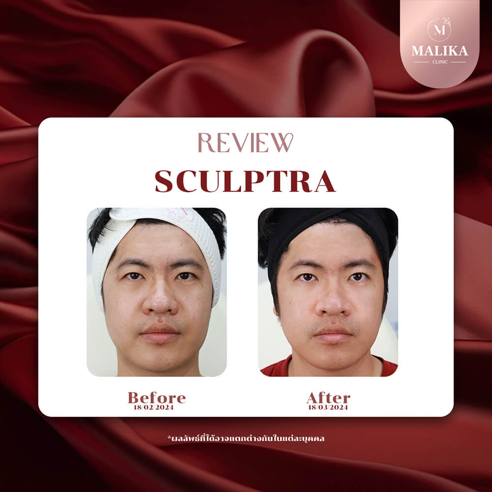 what is scuptra
